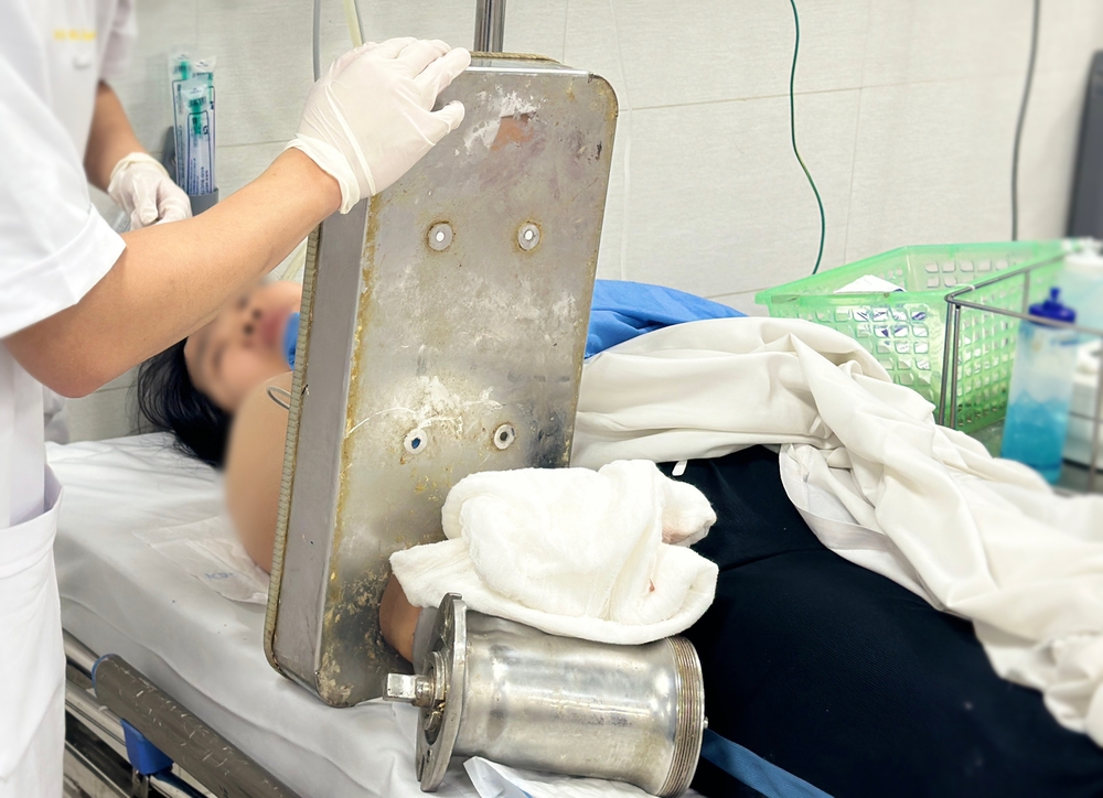 Tai nạn máy xay thịt: Người phụ nữ 36 tuổi phải cắt cụt bàn tay - Ảnh 1.