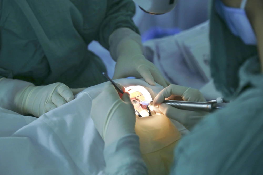 Xóa bỏ "màn sương" đục thể thủy tinh nhờ những tiến bộ của y học hiện đại - Ảnh 1.