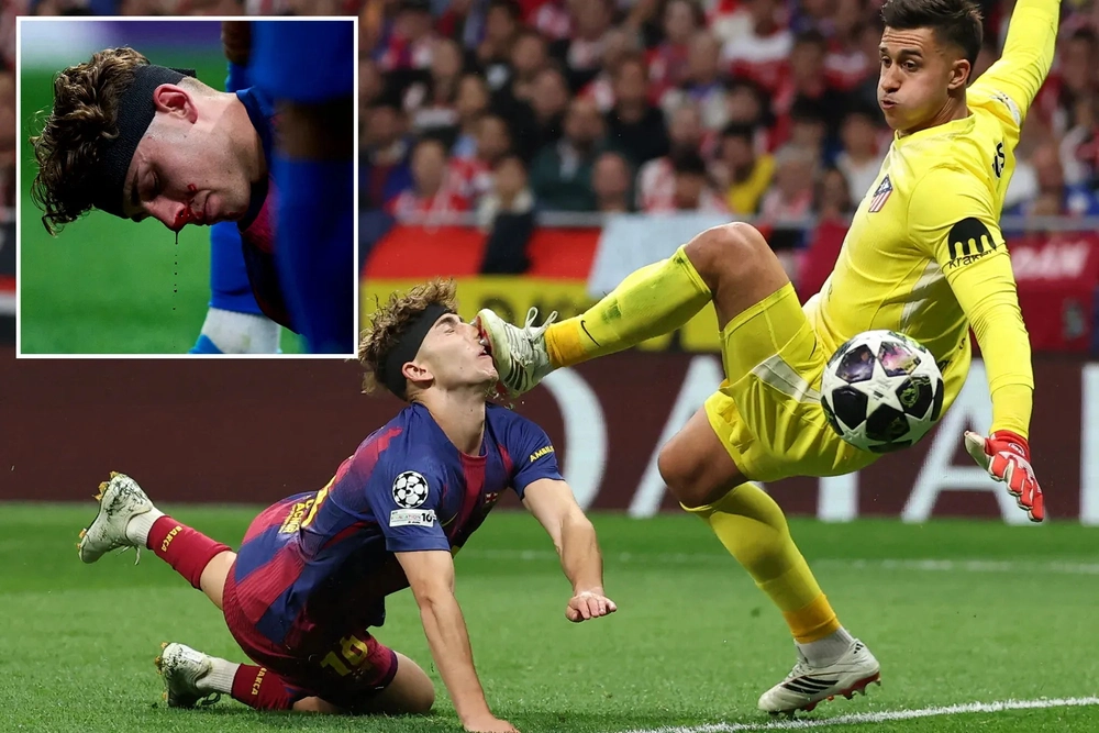 Sao Barcelona bị thủ môn Atletico Madrid đạp vào mặt trong trận đấu ở Champions League - Ảnh 2.