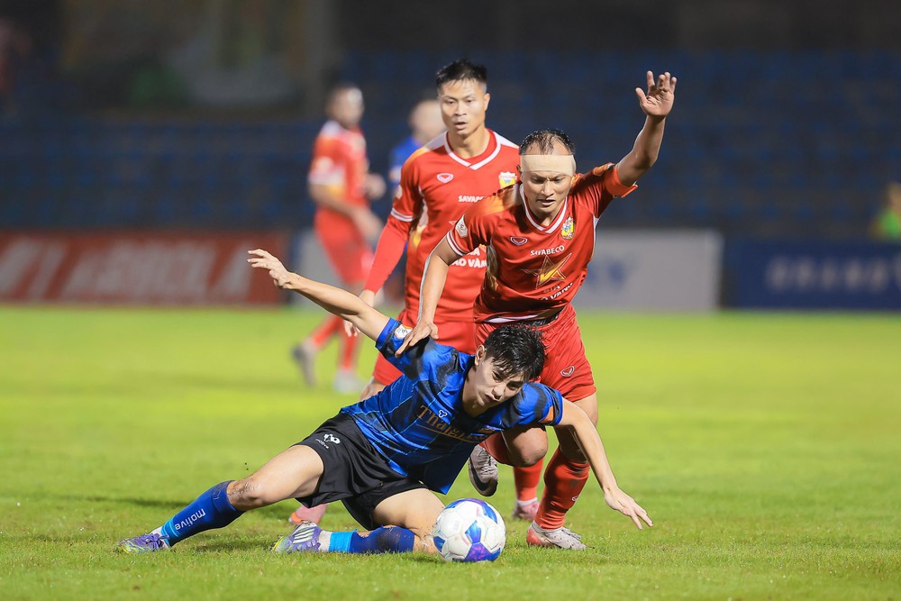 trực tiếp bóng đá