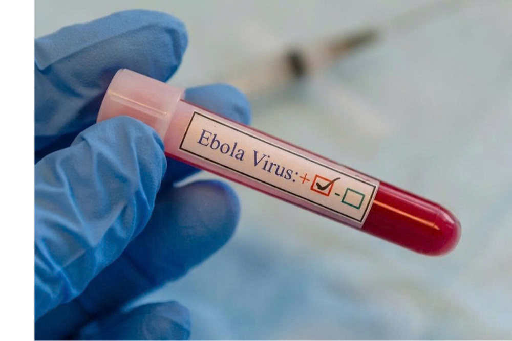 VIỆT NAM SẴN SÀNG ỨNG PHÓ KHẨN CẤP VỚI ĐẠI DỊCH EBOLA - Ảnh 1. VIỆT NAM SẴN SÀNG ỨNG PHÓ KHẨN CẤP VỚI ĐẠI DỊCH EBOLA - Ảnh 1.