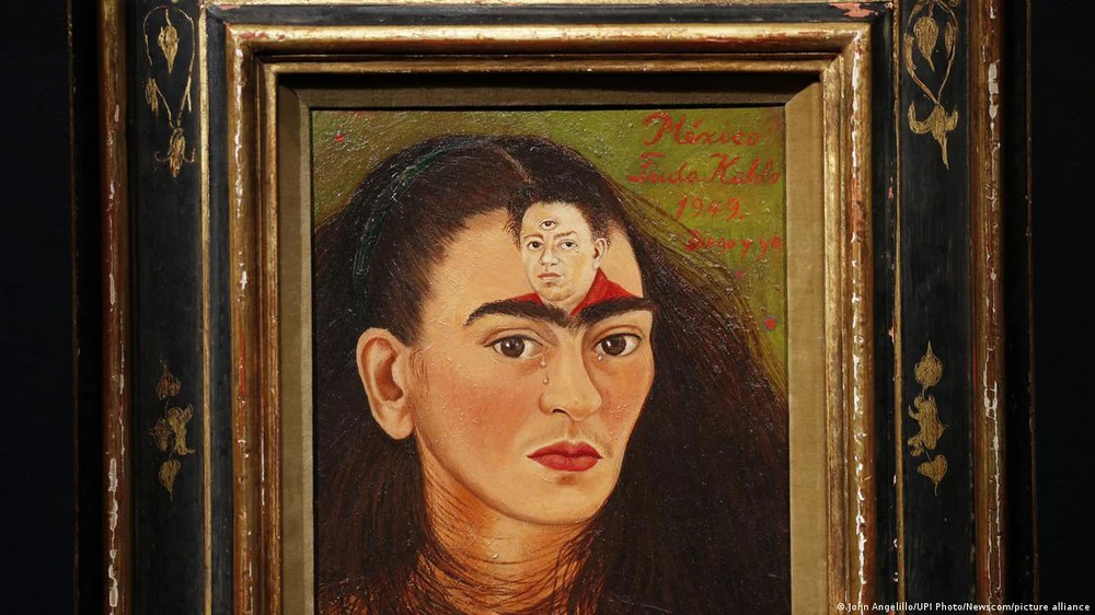 Frida Kahlo: Huyền thoại vượt lên những nỗi đau - Ảnh 5.