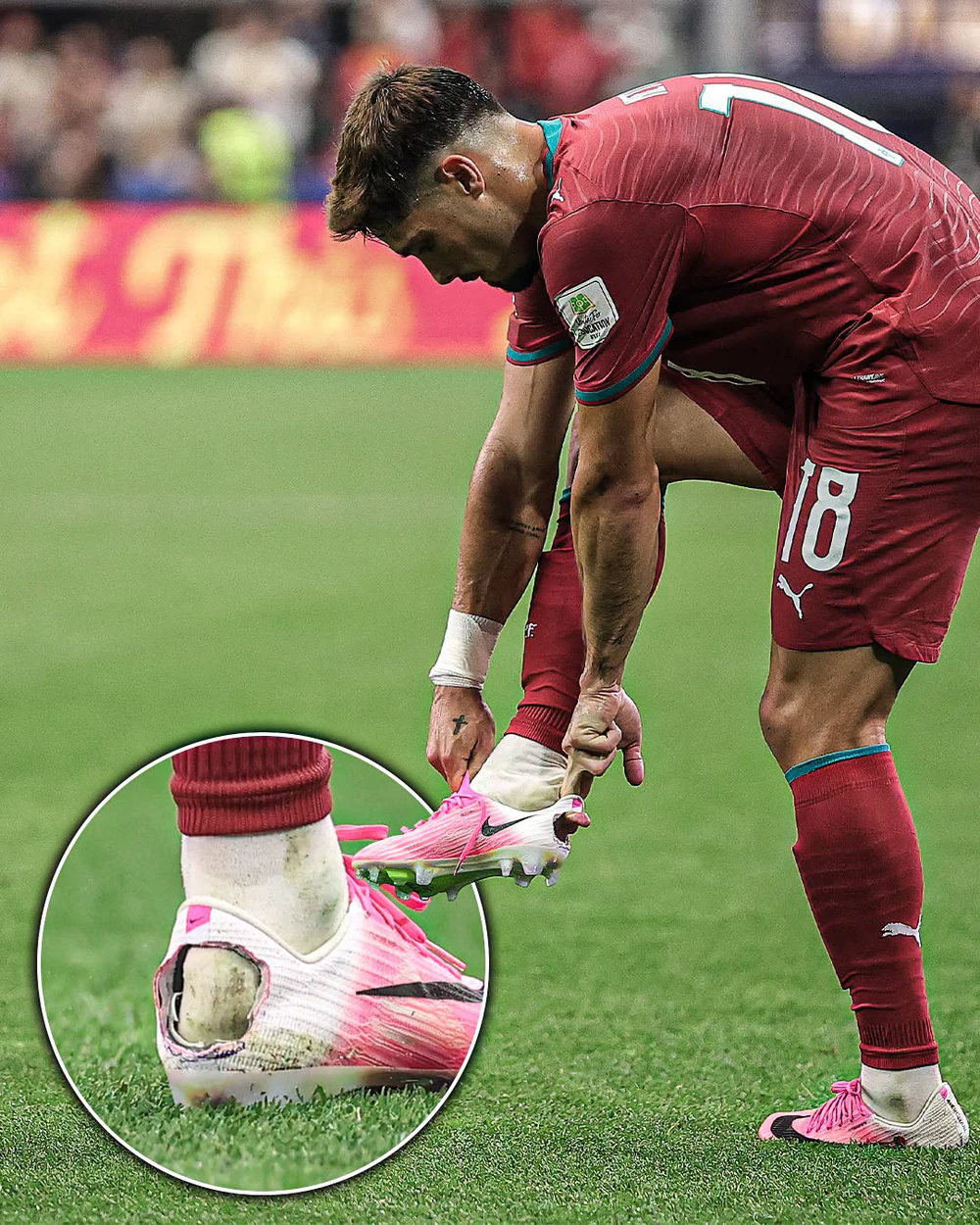 Hậu trường World Cup: Chiếc giày thủng gót & căn bệnh kỳ lạ - Ảnh 1. Hậu trường World Cup: Chiếc giày thủng gót & căn bệnh kỳ lạ - Ảnh 1.