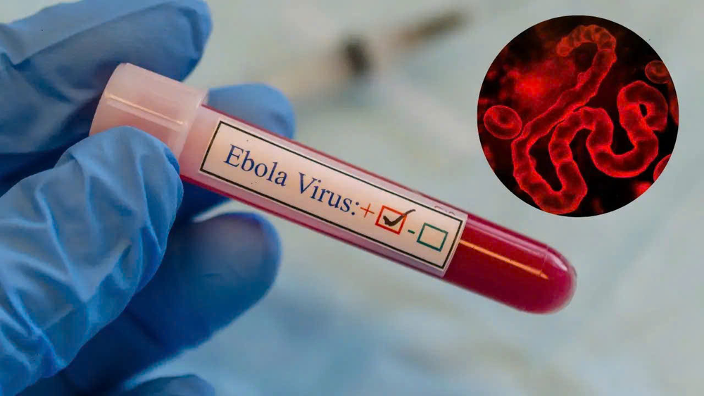 Không nên hoang mang trước những thông tin chưa kiểm chứng về bệnh do virus Ebola - Ảnh 1.
