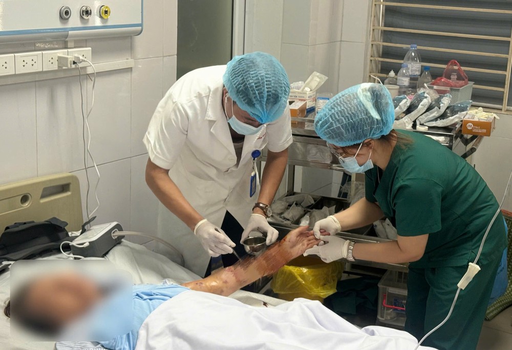 Ngày Thế giới phòng chống bệnh dại 28/9: Cảnh báo nguy cơ tổn thương nặng và nhiễm trùng từ vết chó cắn - Ảnh 1. Ngày Thế giới phòng chống bệnh dại 28/9: Cảnh báo nguy cơ tổn thương nặng và nhiễm trùng từ vết chó cắn - Ảnh 1.