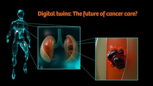 Thử nghiệm điều trị ung thư bằng AI và công nghệ song sinh kỹ thuật số