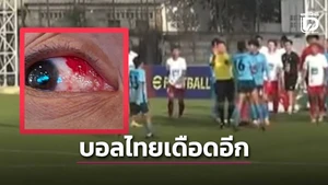 Tức giận vì bị đuổi, cầu thủ Thái Lan đấm trọng tài, hành hung đối phương suýt mù mắt