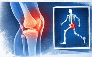 Chấn thương thể thao không phải do “xui xẻo”: Chuyên gia chỉ ra nguyên nhân và cách xử trí đúng cách