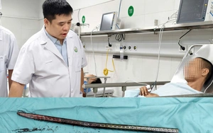 Xuyên đùi bởi xà beng 1,5m: Ca cấp cứu cân não tại Bệnh viện Việt Đức