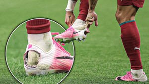 Hậu trường World Cup: Chiếc giày thủng gót & căn bệnh kỳ lạ