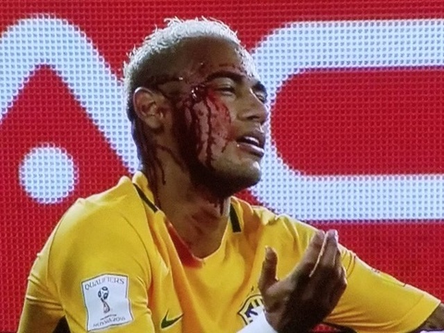 Brazil 5-0 Bolivia: Neymar bị đánh chảy máu trong ngày ghi bàn thứ 300 trong sự nghiệp 