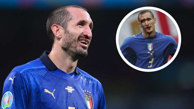 Nhận định Anh vs Ý (VTV3 trực tiếp): Chiellini đã sẵn sàng cho trận chiến cuối