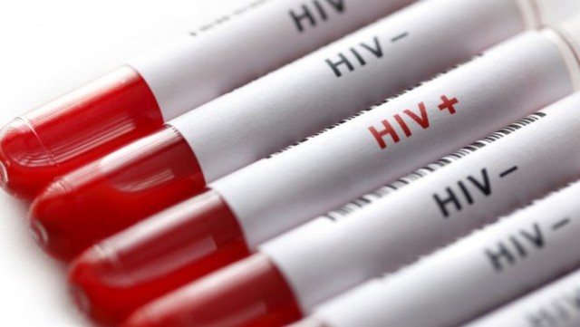 Chưa thể mừng, dù thế giới đã có bệnh nhân thứ hai thoát khỏi HIV 