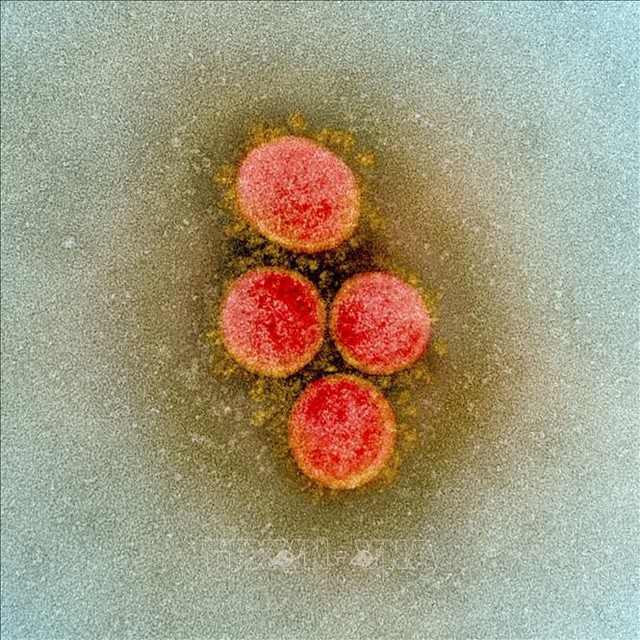  Hình ảnh quét qua kính hiển vi điện tử cho thấy virus SARS-COV-2 lấy từ mẫu bệnh phẩm của bệnh nhân COVID-19 tại Viện Nghiên cứu Dị ứng và Bệnh Truyền nhiễm Quốc gia, Fort Detrick, Maryland, Mỹ ngày 15/7/2020. Ảnh: AFP/TTXVN