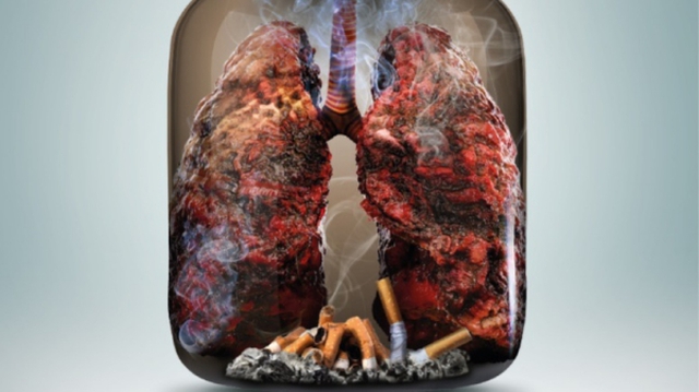 Ngày Thế giới không thuốc lá 31/5: Thuốc lá và các bệnh về phổi