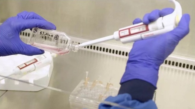 Tế bào máu nuôi cấy trong phòng thí nghiệm lần đầu tiên được truyền vào cơ thể người - Ảnh 3.