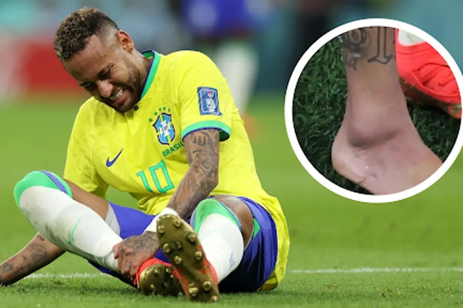 Neymar chấn thương mắt cá, nghỉ hết vòng bảng - Ảnh 3.