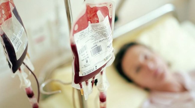 Nghiên cứu phát hiện nhóm máu dễ mắc ung thư đại trực tràng nhất: Căn bệnh khiến 900.000 người tử vong/năm trên toàn thế giới - Ảnh 3.