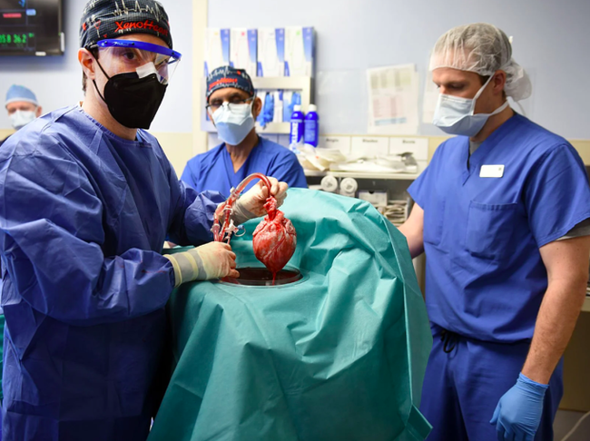 Những dấu ấn đột phá trong nền y học thế giới 2022: Ca ghép tim đầu tiên từ lợn sang người, tiếp thêm niềm hy vọng trong điều trị ung thư - Ảnh 2.