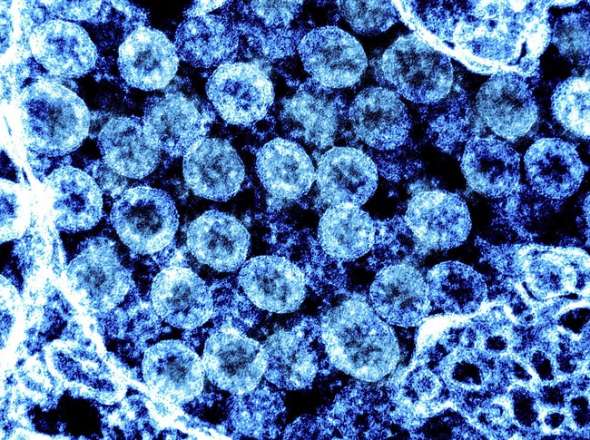 Các nhà khoa học Anh mở rộng giải trình tự gene đối với virus gây các bệnh hô hấp ngoài Covid-19 - Ảnh 1.