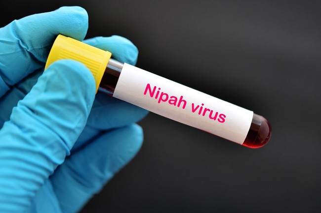 Indonesia kêu gọi cảnh giác với virus Nipah - Ảnh 1.