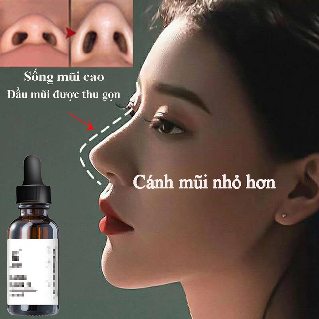 Serum nâng mũi  - Ảnh 1.