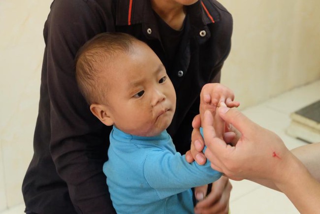 Phẫu thuật cho trẻ khuyết tật và tổ chức các hoạt động thiện nguyện tại bệnh viên đa khoa tỉnh Hà Giang - Ảnh 2.