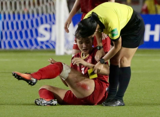 Chương Thị Kiều bị chảy máu đùi ở trận chung kết bóng đá nữ SEA Gamé 30 gặp Thái Lan