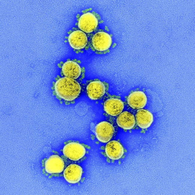 WHO theo dõi biến thể mới của virus SARS-CoV-2 lan rộng ở Anh và Mỹ - Ảnh 1.