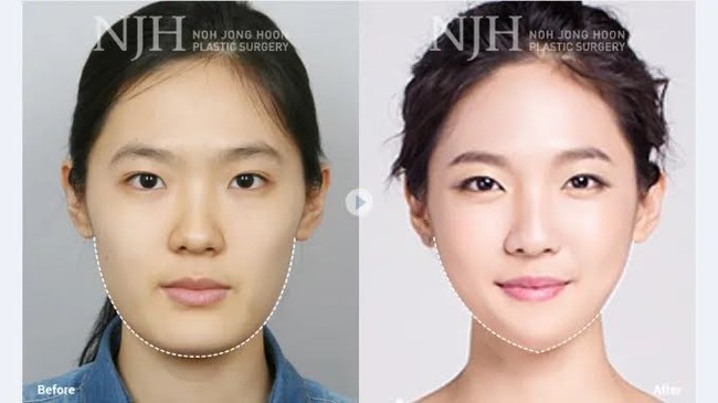 Nam giới ở Hàn Quốc muốn phẫu thuật thẩm mỹ giống 2 thần tượng K-pop này nhất - Ảnh 1.