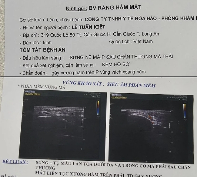 Trọng tài Việt Nam bị cầu thủ đánh gãy xương, thương tích 13% - Ảnh 3.