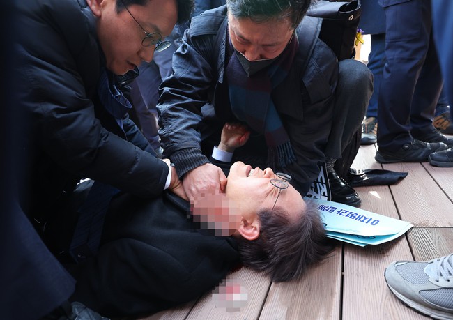 Chính khách Hàn Quốc bị tấn công bằng dao - Ảnh 2.