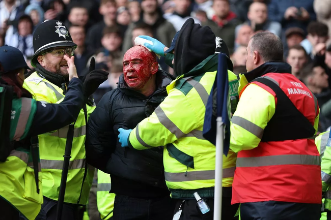 Bạo loạn ở FA Cup, cầu thủ phải giải cứu người thân - Ảnh 4.