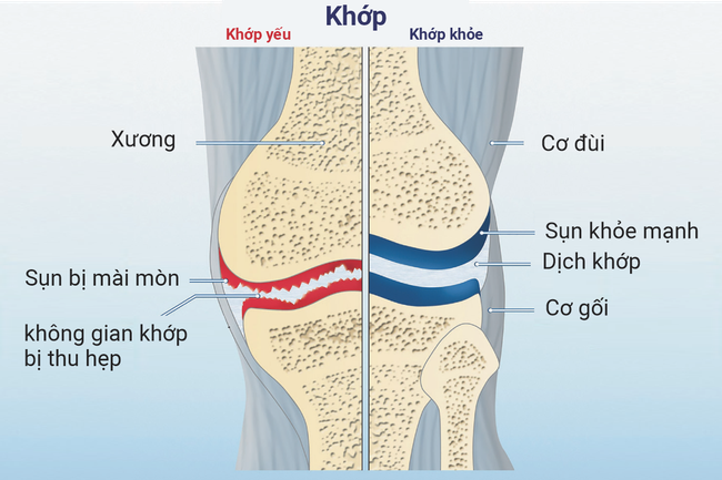 Review: Collagen Xương khớp CH-Alpha PLUS có hiệu quả không? - Ảnh 1.