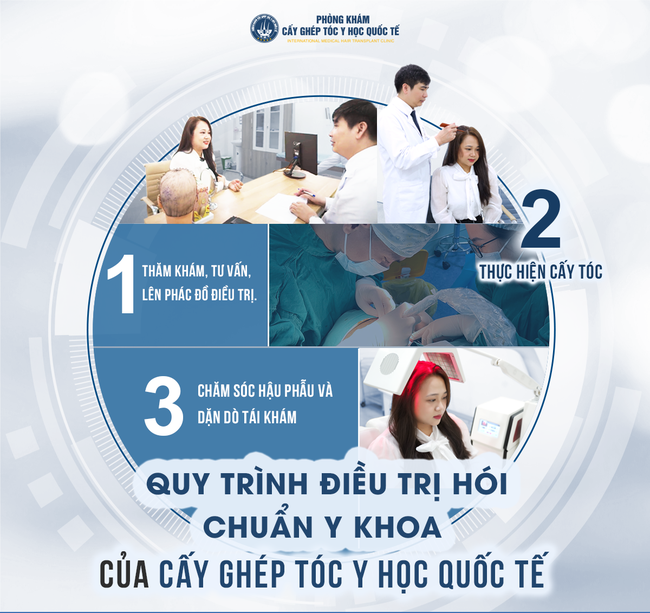 Khám phá công nghệ cấy tóc hiện đại tại Viện cấy tóc Quốc tế - Ảnh 2.