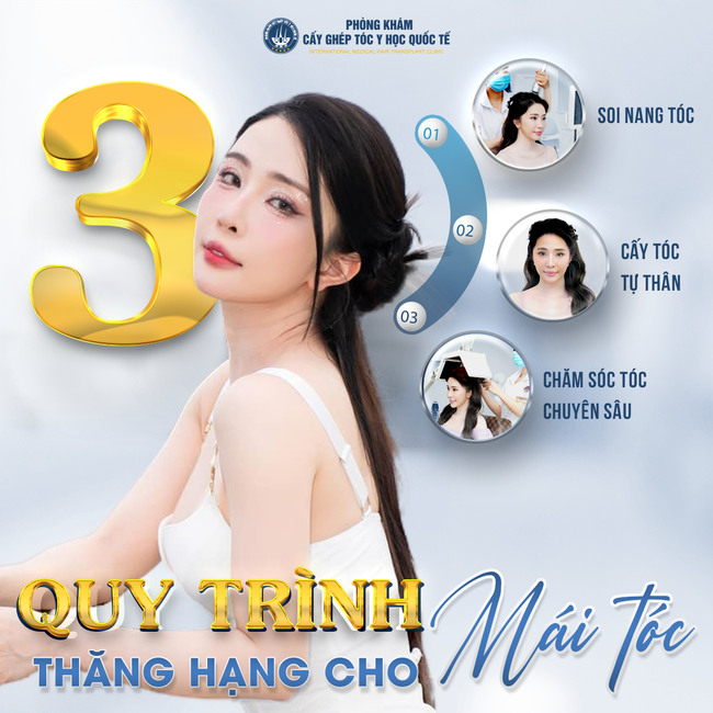 Khám phá công nghệ cấy tóc hiện đại tại Viện cấy tóc Quốc tế - Ảnh 4.