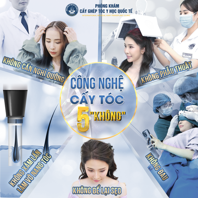 Khám phá công nghệ cấy tóc hiện đại tại Viện cấy tóc Quốc tế - Ảnh 5.