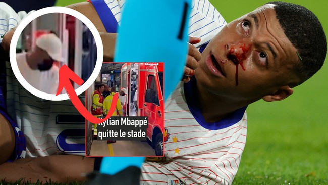 Tin nóng EURO 18/6: Mbappe lên tiếng về sự cố gãy mũi ở EURO, cầu thủ đầu tiên nhận án phạt nguội - Ảnh 1.
