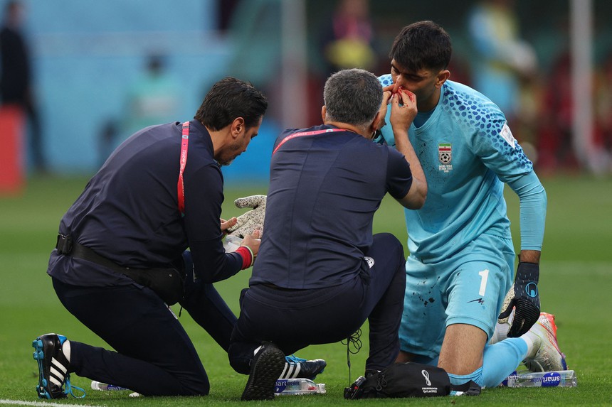 Thủ môn của Iran va chạm mạnh vùng mặt với đồng đội, phải rời sân dù nỗ lực thi đấu tiếp - Ảnh 3.