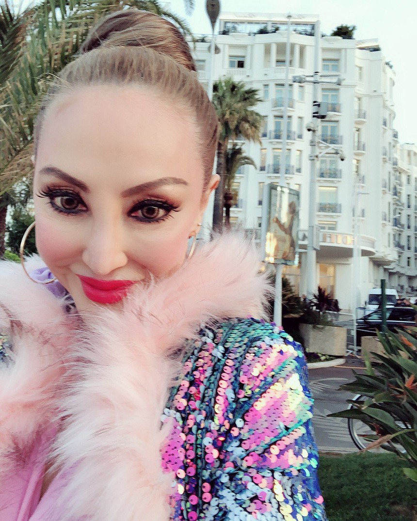 Mỹ nhân màn ảnh trở thành "thảm họa mặt rắn": Bị bỏ rơi ở liên hoan phim quốc tế, sự thật đau lòng lại không ai quan tâm - Ảnh 6.