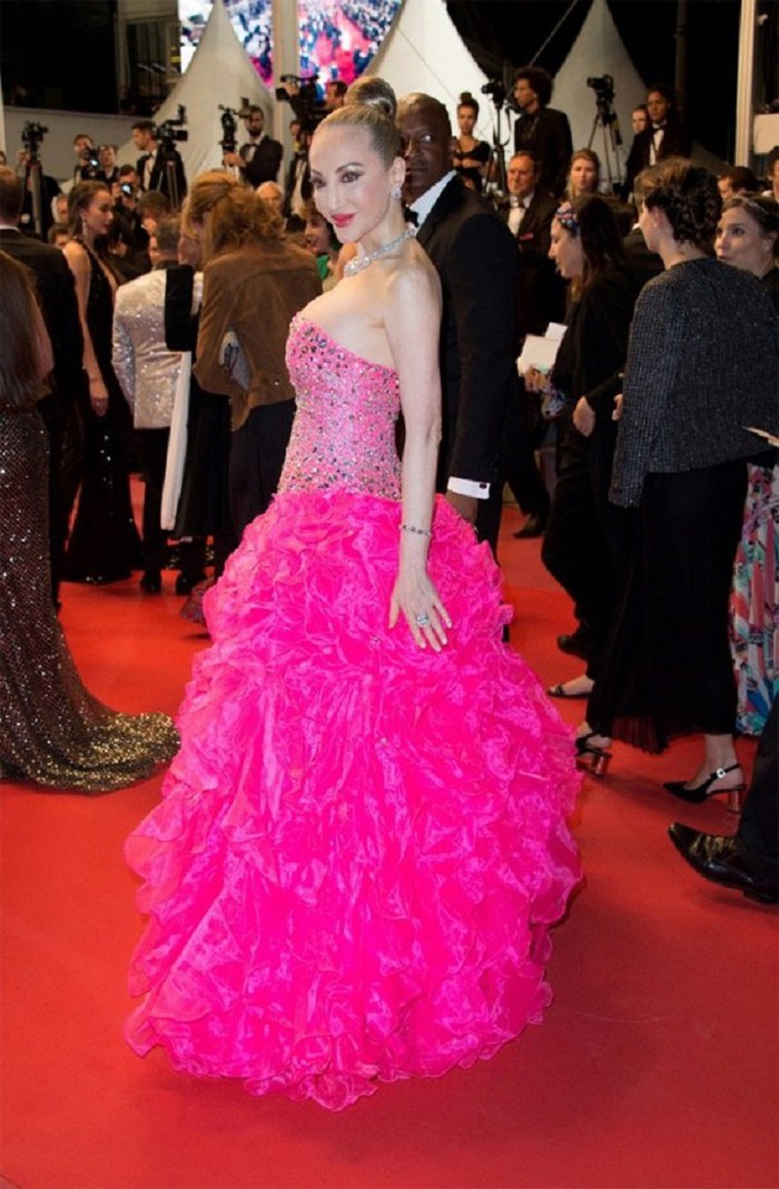 Mỹ nhân màn ảnh trở thành "thảm họa mặt rắn": Bị bỏ rơi ở liên hoan phim quốc tế, sự thật đau lòng lại không ai quan tâm - Ảnh 5.