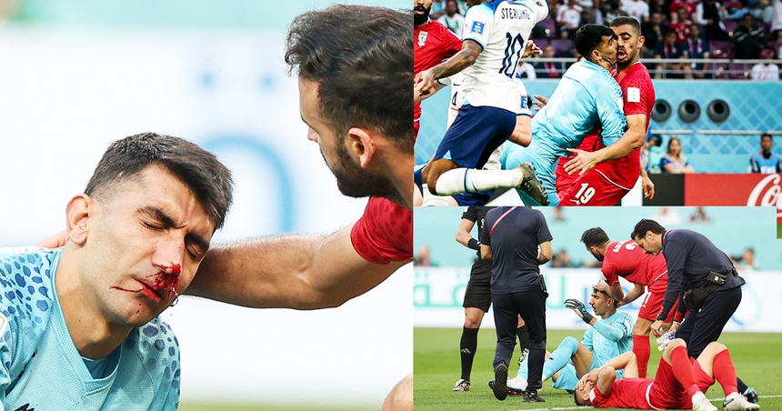 Xứ Wales vs Iran (VTV5 trực tiếp): Hiểm họa từ trên không - Ảnh 3.