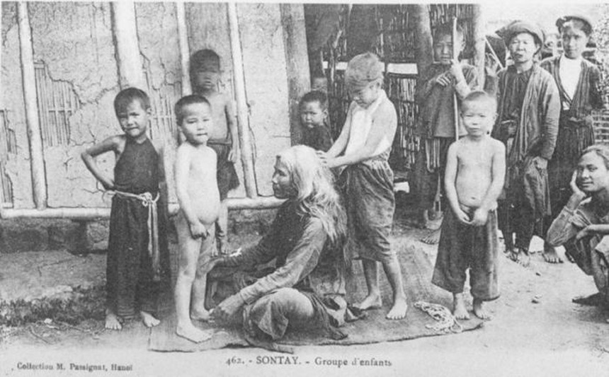 Ảnh = Ký ức = Lịch sử (Kỳ 56): Bắt chấy - Ảnh 2.