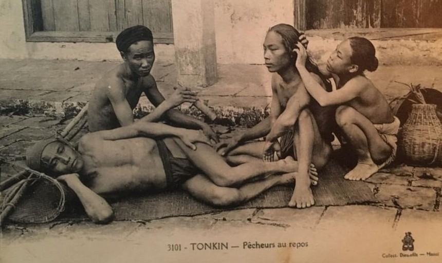 Ảnh = Ký ức = Lịch sử (Kỳ 56): Bắt chấy - Ảnh 5.