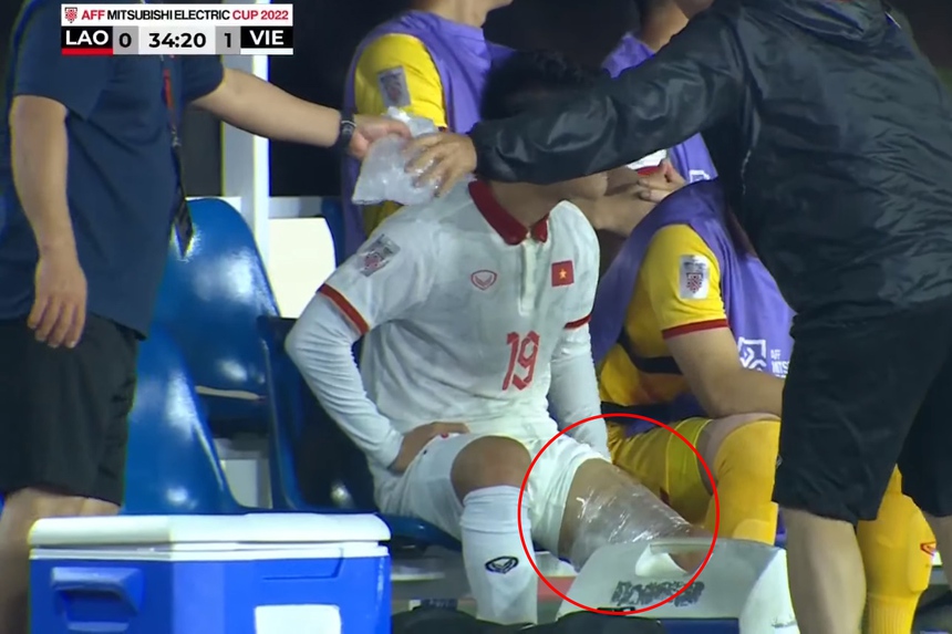 Vì sao Quang Hải phải rời sân sớm? - Ảnh 3.