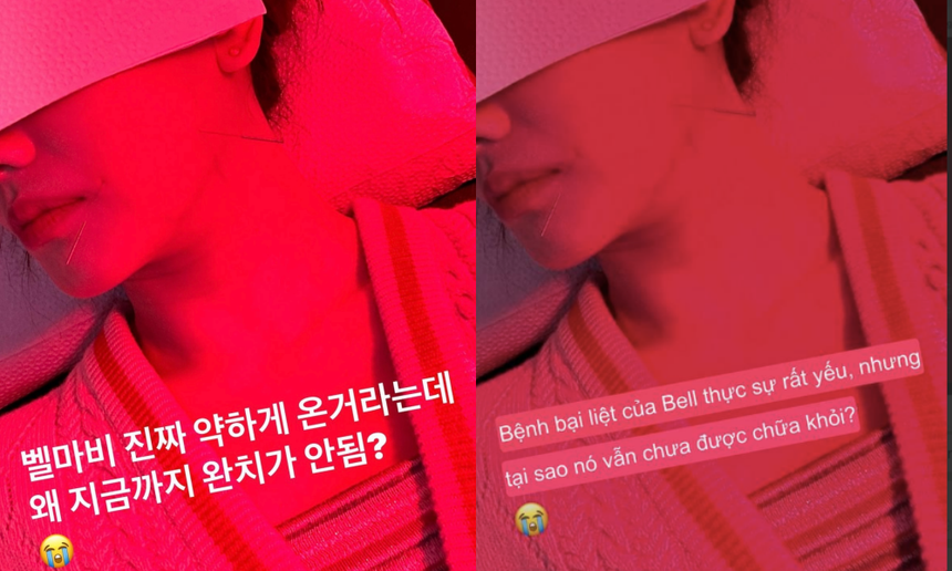 Tình trạng sức khoẻ đáng lo của Hari Won sau 4 tháng trị liệt nửa mặt  - Ảnh 1.