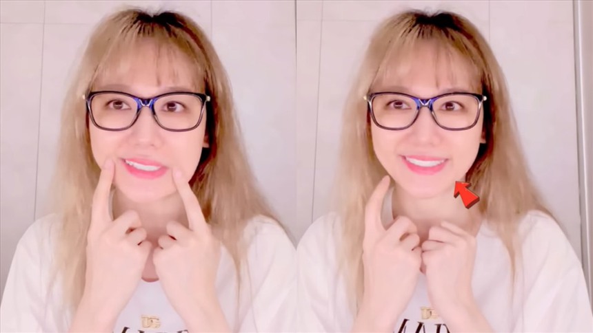 Tình trạng sức khoẻ đáng lo của Hari Won sau 4 tháng trị liệt nửa mặt  - Ảnh 2.