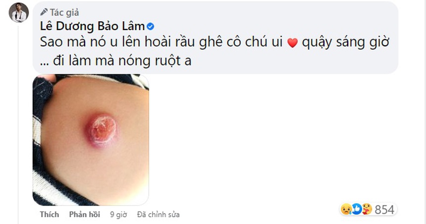 Con Lê Dương Bảo Lâm vào viện, lý do chung khiến nhiều phụ huynh lo "sốt vó" - Ảnh 2.