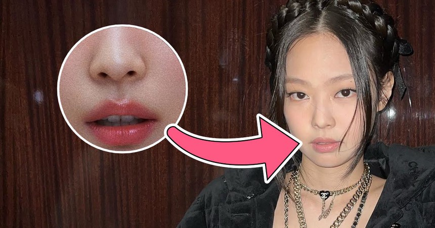 Lý do Jennie Blackpink được chọn là hình mẫu khi 'dao kéo' - Ảnh 7.