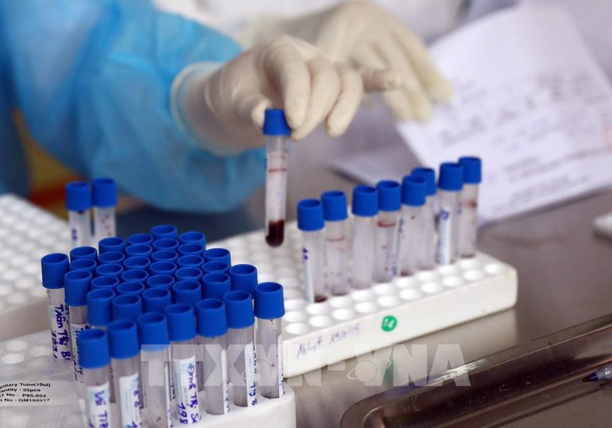 Chuyển cơ quan điều tra, làm rõ hàng chục gói thầu mua sắm y tế chống dịch Covid-19 ở Hà Nội - Ảnh 1. Chuyển cơ quan điều tra, làm rõ hàng chục gói thầu mua sắm y tế chống dịch Covid-19 ở Hà Nội - Ảnh 1.